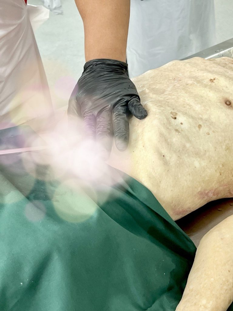Embalming