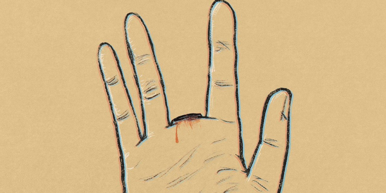 hand 5786364 1280 panorama 38f7e7708ecc023b8981dbcd037c5d63 661fe69536357 - Cremation of A Body Part